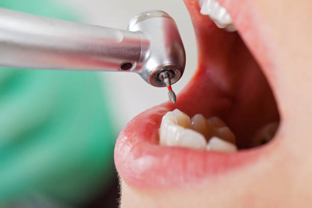 Best Emergency Dental Care for Trauma or Injury in Mila Doce, TX